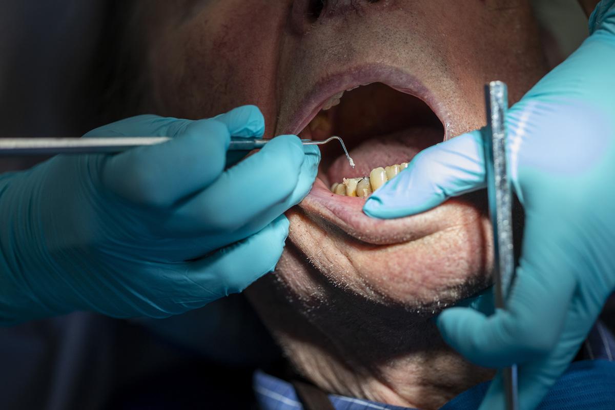 Dentist: Strange to Preempt the Investigation