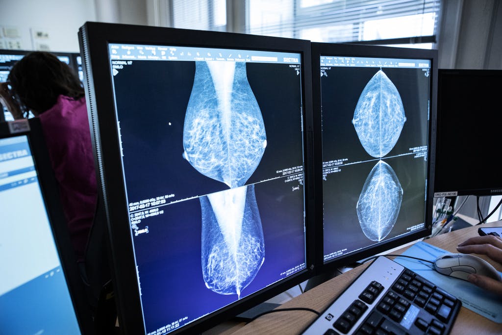 Demand: Call in older women for mammography